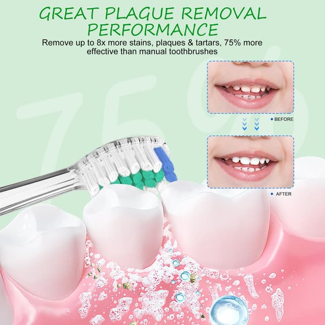 Detalle 2 de Kinder-Ersatzbürsten für Seago & Teeteck: 5er-Set kompatibel mit SG-513/SG-977/SG-2139 (ab 3 Jahren)