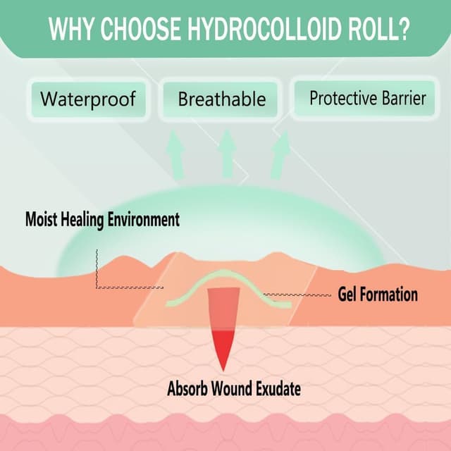 Detalle de Zemolo Pimple Rolle Hydrokolloid