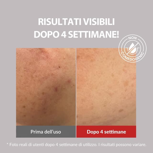 Detalle de MIZON Good Bye Blemish Soothing Gel Cream 55 ml, crema gel lenitiva per pelle grassa a tendenza acneica