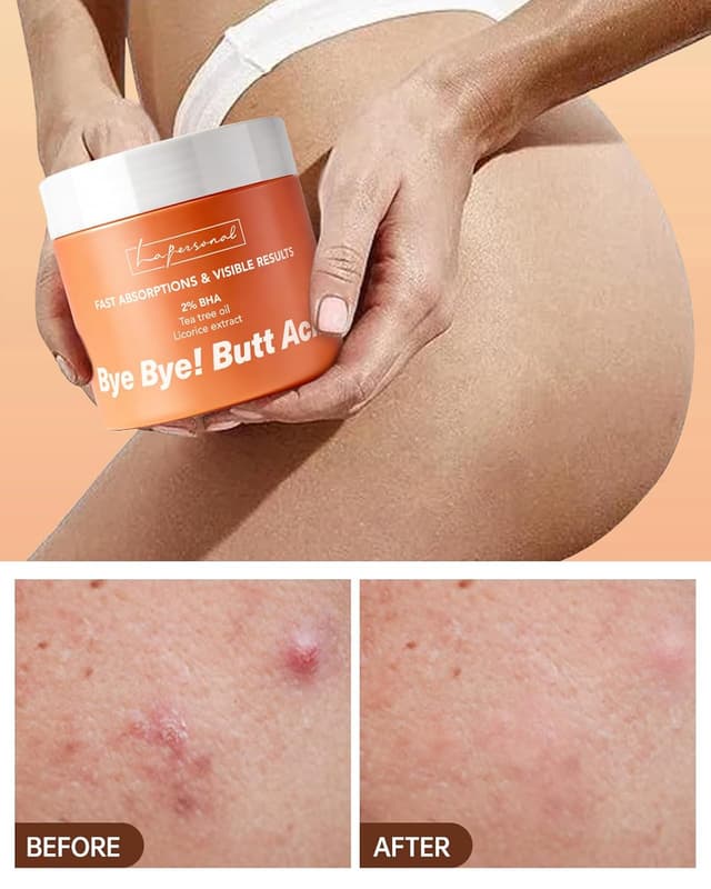 Thumbnail 4 de LA.PERSONAL Body Acne Cream 160 ml