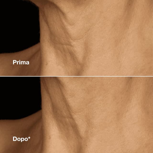 Detalle 2 de Clinique Smart Clinical Repair Lifting Face + Neck Crema Viso e Collo Anti-Età 50 ml