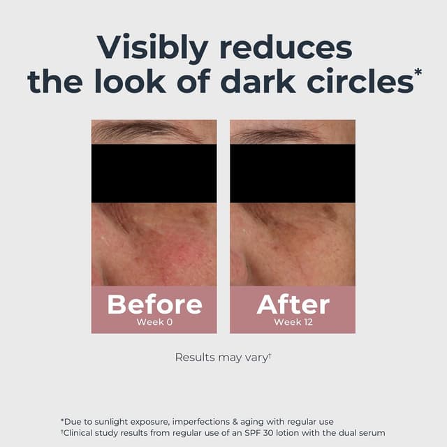 Detalle de Eucerin Radiant Tone Eye Cream for Dark Circles & Eye Puffiness (Thiamidol + Hyaluronic Acid), 0.5 oz