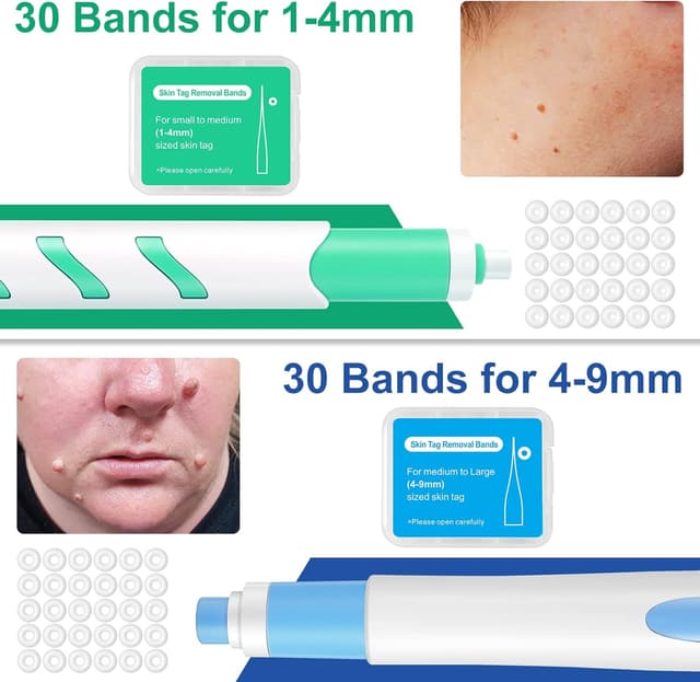 Detalle 2 de Kit de traitement d’acrochordons VFjVlVdG (1 à 9 mm) pour verrues et grains de beauté