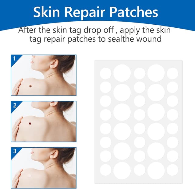 Thumbnail 3 de Skin Tag Removal 2‑in‑1 Auto Kit