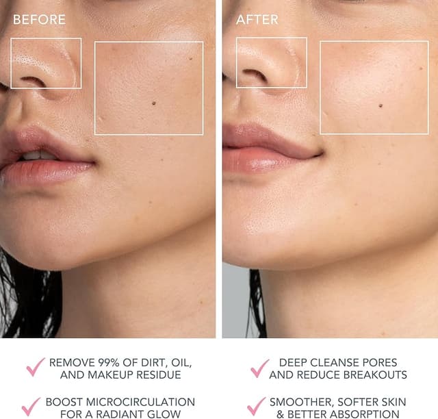 Thumbnail 4 de FOREO LUNA 4 mini cepillo facial Pearl Pink