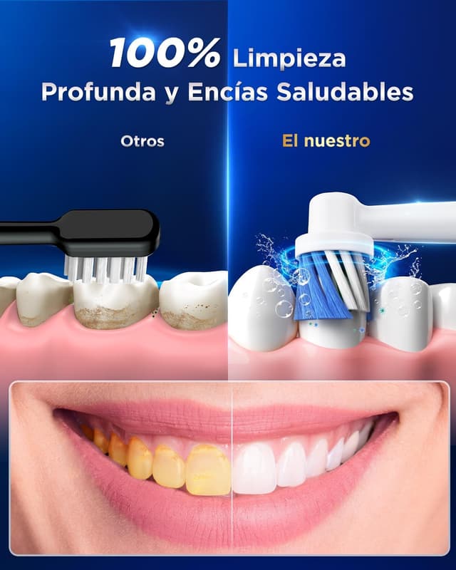 Thumbnail 2 de YTEATH PRO Cepillo eléctrico para dientes sensibles