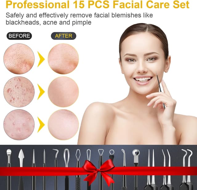Thumbnail 4 de IUMAKEVP 15-piece blackhead extractor kit