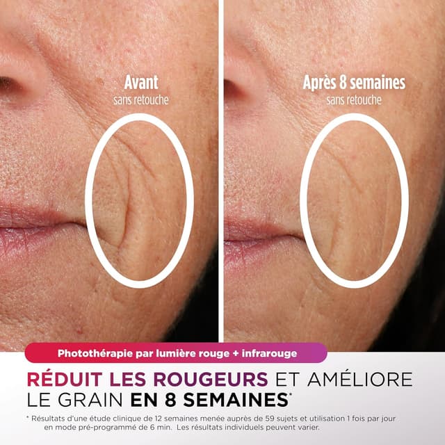 Detalle 2 de Shark CryoGlow Masque LED