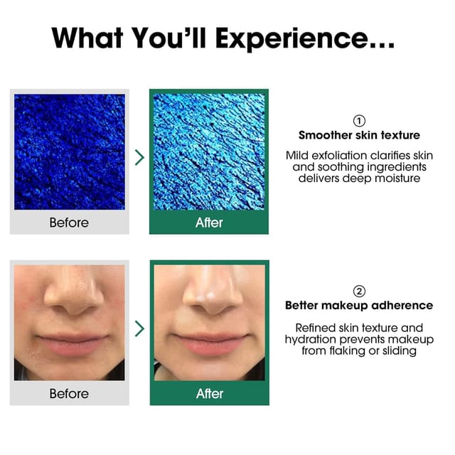 Thumbnail 4 de SOME BY MI AHA BHA PHA Toner with 2% Niacinamide ⚙