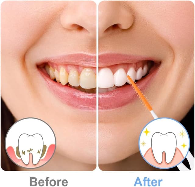 Detalle 1 de URAQT interdental brushes 220pcs orange