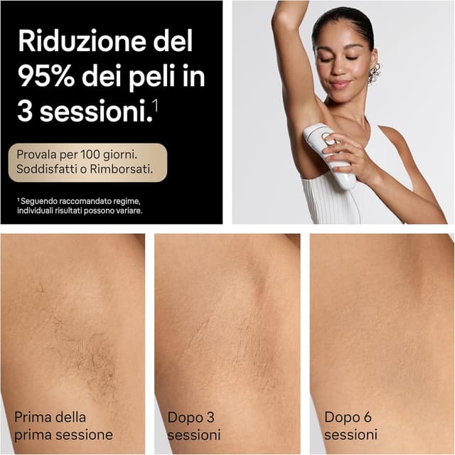 Detalle de Braun Silk·expert Pro 5 (PL5321) – Epilatore a luce pulsata smart per riduzione dei peli a casa, con 3 testine e custodia