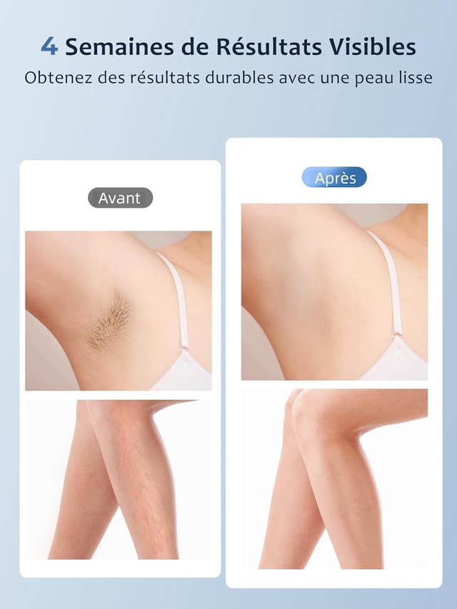 Thumbnail 4 de Épilateur à lumière pulsée 999 900 flashes ⚡