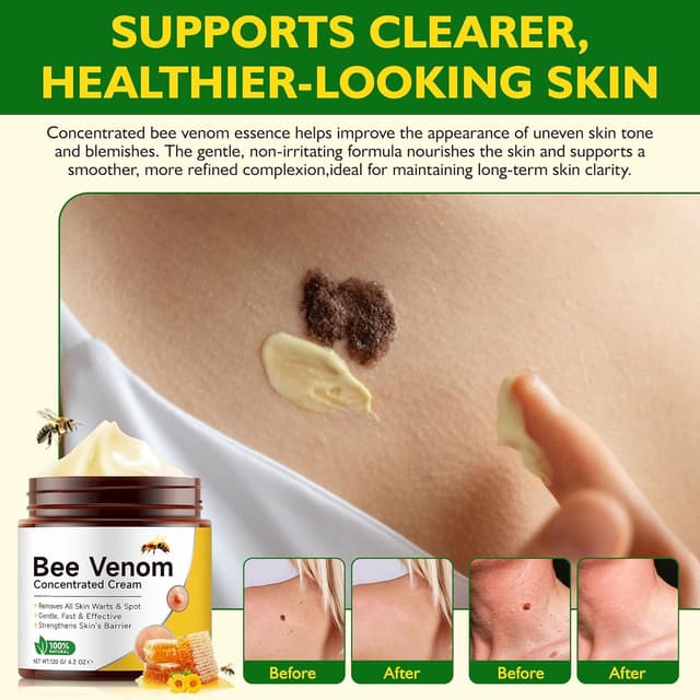Detalle de Bee Venom Cream 120g wart & tag remover