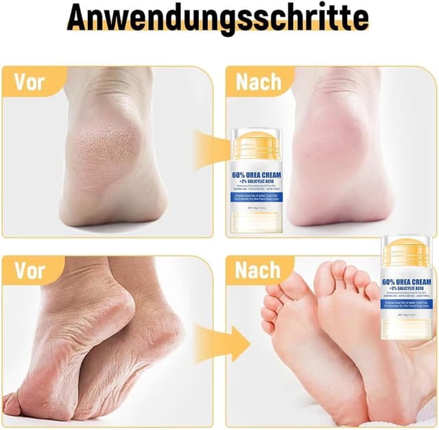 Thumbnail 6 de 2Pieza Crema Urea 60% para pies