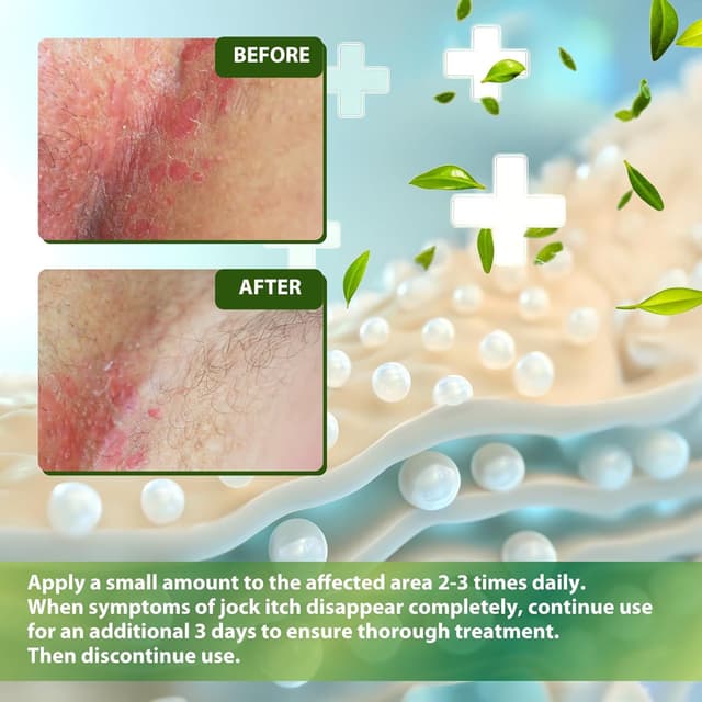 Detalle de Natürlich Antimykotika Hautpilz Creme 30 g