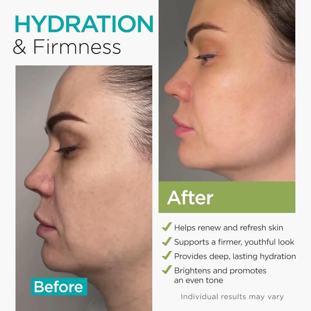 Detalle 2 de Collagen NAD+ Retinol, Niacinamide & Hyaluronic Acid Face Cream (Airless Pump) — Day & Night Anti-Aging Moisturizer, 1.7 oz