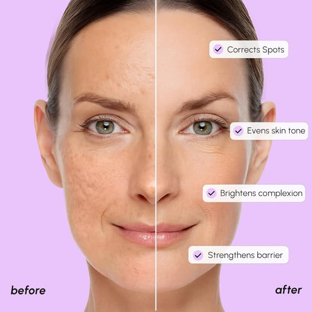 Detalle 2 de MAREE 20% Tranexamic Acid Serum for Dark Spots