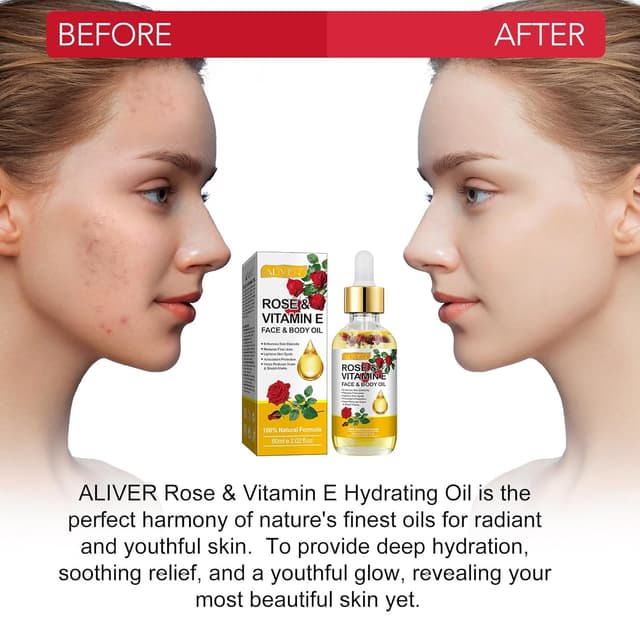 Thumbnail 3 de Rosenöl Gesicht mit Rosenblüten 60ml