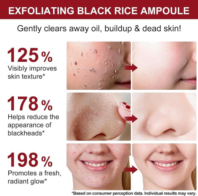 Detalle 2 de Peel Shot Glow Rice Ampoule Duo, siero 2 pack