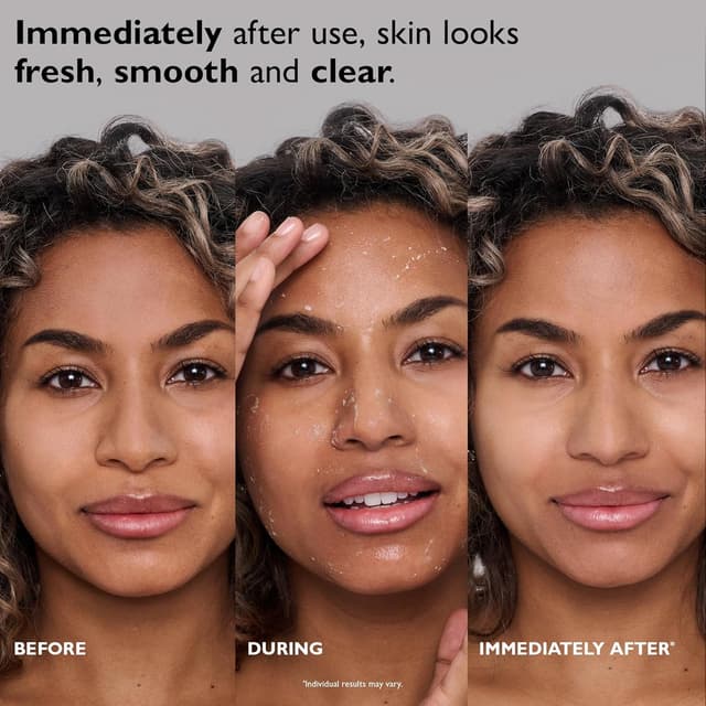 Thumbnail 6 de Peter Thomas Roth FirmX Peeling Gel 100 ml