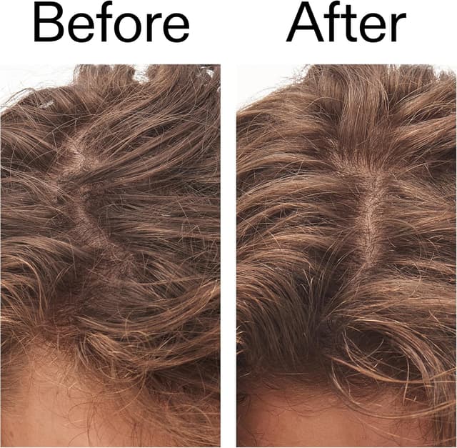 Thumbnail 5 de The INKEY List Exfoliante de Cuero Cabelludo con Ácido Glicólico 🌿, 150 ml