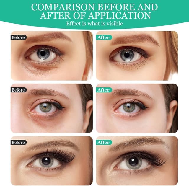 Detalle 2 de LOPHE Patch Yeux hydrogel (30 paires) pour réduire cernes et poches