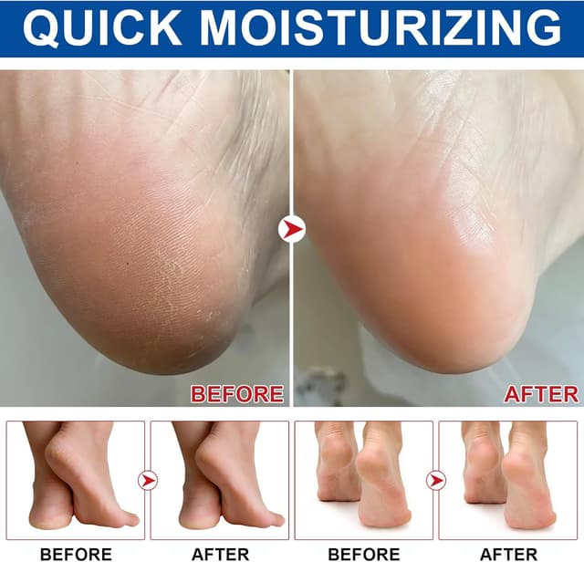 Thumbnail 6 de Crema para Pies Secos 60% Urea 2 Piezas