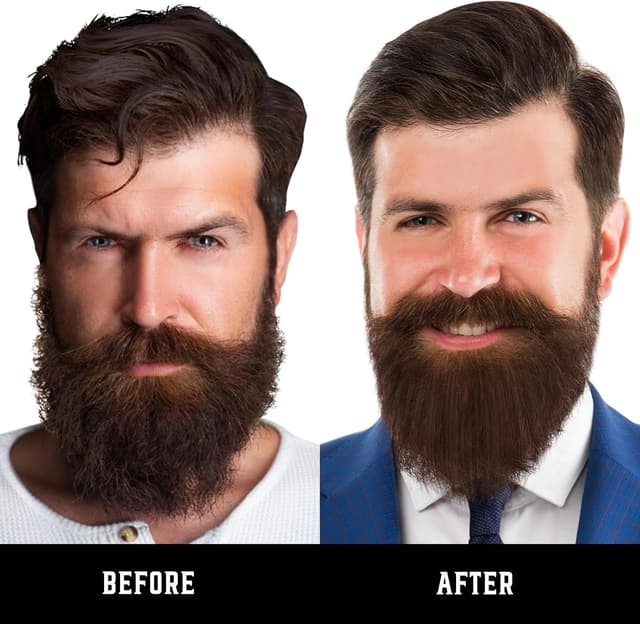 Detalle 2 de FEBOTE Heated Ionic Hair Straightening Brush for Men with 5 Heat Settings and Travel Bag