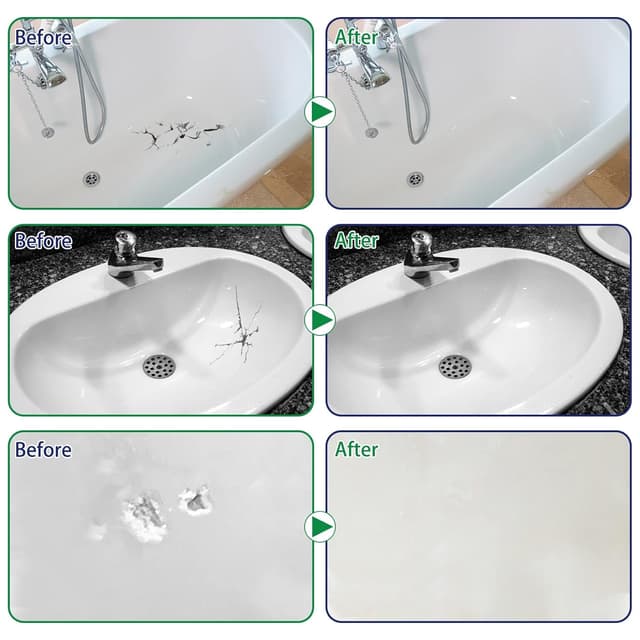 Detalle de Wansiven Kit di riparazione vasca da bagno e doccia in resina epossidica (bianco), 100 g