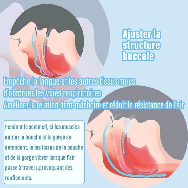 Detalle de Anti Ronflement Efficace Puissant : gouttière dentaire anti-ronflement en TPE souple (lot de 2 pièces) AIOUTGOGO