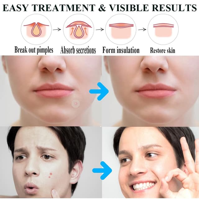 Thumbnail 5 de Zemolo Pickel Patch 300 Stück 🩹