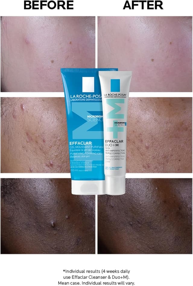 Detalle 2 de La Roche-Posay Effaclar Duo+ 40ml Anti-Breakout Gel