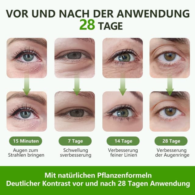 Thumbnail 4 de Augenpads 60 PCS Hyaluronsäure Augenmaske 🧴