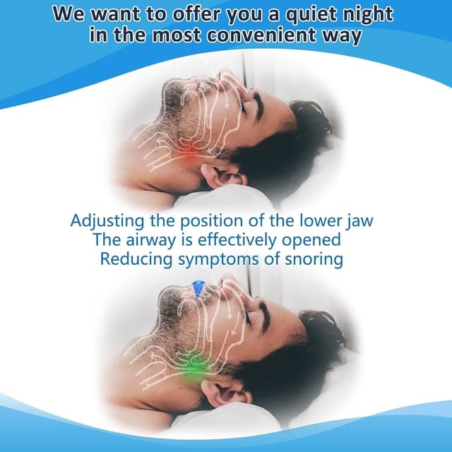 Thumbnail 1 de Snoring Aids Anti Snoring Mouthpiece — Soft Stopper 😷