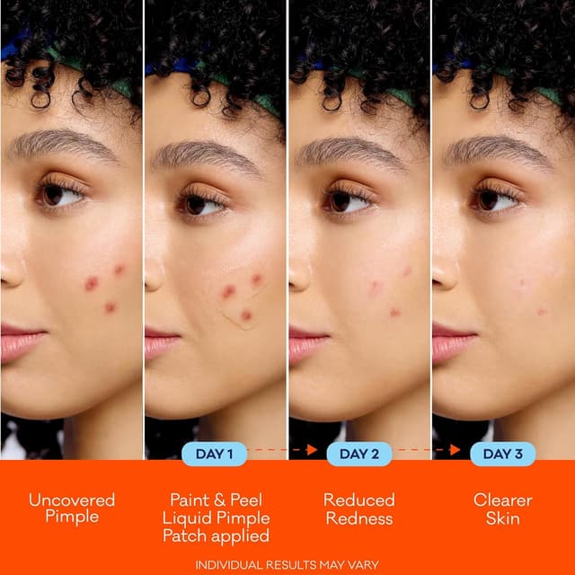 Detalle de Bioré Paint & Peel Liquid Pimple Patch with 1% Salicylic Acid (Up to 100 Uses), .5 Oz