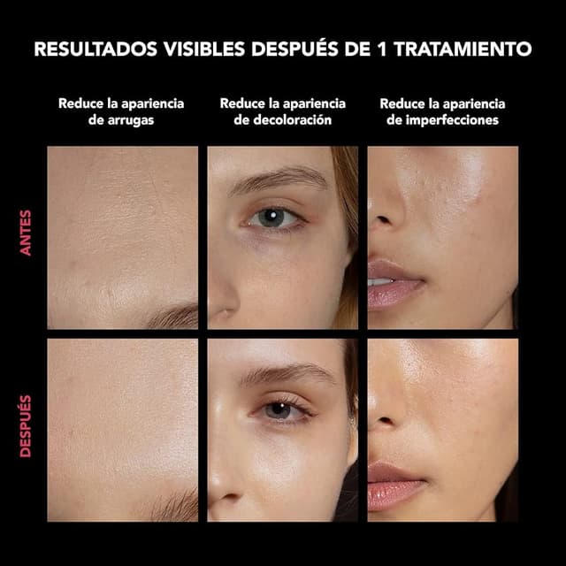 Thumbnail 3 de FAQ 202 Máscara Facial de Luminoterapia NIR + 7 LED 🌟