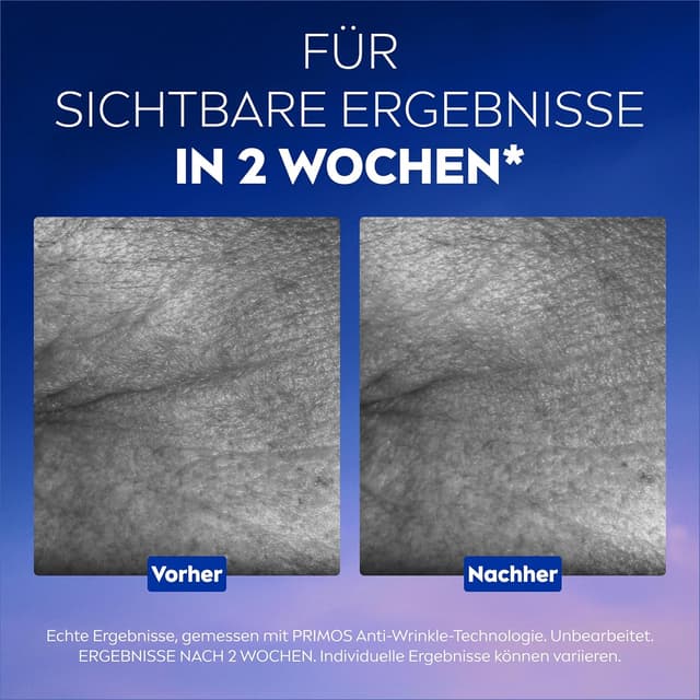 Detalle de NIVEA CELLULAR Expert Filler & Epigenetics Set: Tagescreme, Nachtcreme & Serum (Geschenkset)
