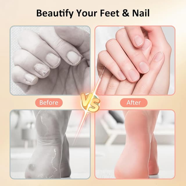 Detalle 2 de 2-in-1 Electric Callus Remover 9-Speed