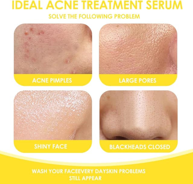 Thumbnail 2 de Siero anti-acne viso 30 ml con contagocce