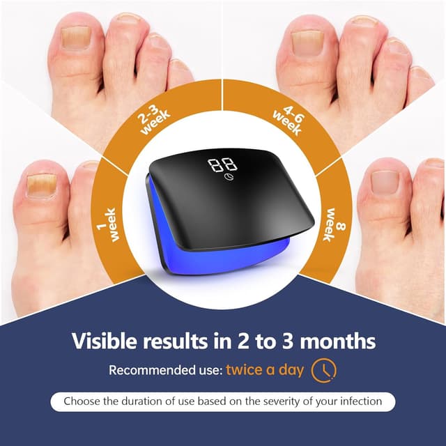 Thumbnail 4 de Suuprone Upgrade Nagelpilz-Lasergerät 15 LED 🔬?