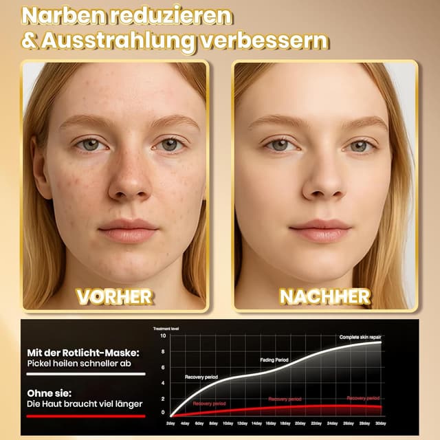 Thumbnail 5 de Rotlichtlampe LED Maske – 4-Farben-Lichttherapie 240 LEDs