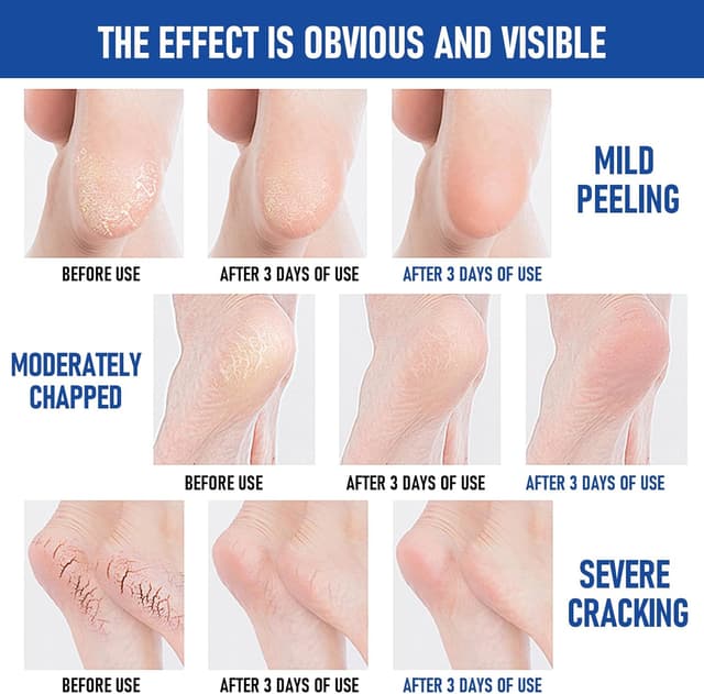 Thumbnail 3 de Crema Reparadora Talones Agrietados 2Pcs