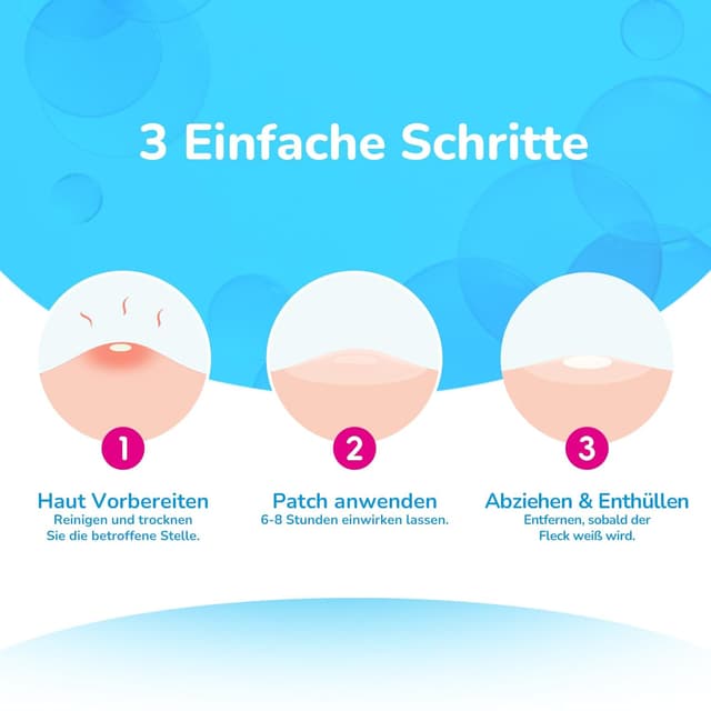 Thumbnail 6 de Bagavs Pickel Patch Acne Patch 72 Stück