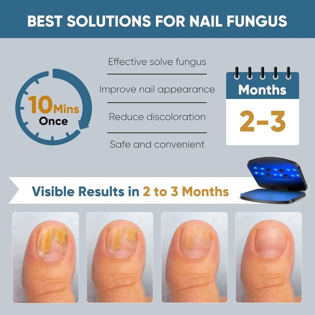 Thumbnail 2 de Nagelpilz Lasergerät 15 LEDs