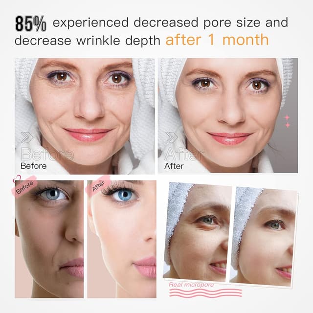 Thumbnail 2 de IBORRIA Máscara LED de Terapia Lumínica Facial 🌟