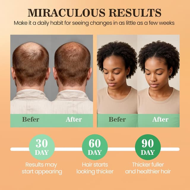 Thumbnail 3 de Batana Oil for Hair Growth 4.06 Fl Oz