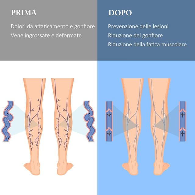 Detalle 2 de Calze a compressione graduata 20–30 mmHg unisex con cerniera, punta aperta e taglie forti (XXL–7XL) – 1 paio