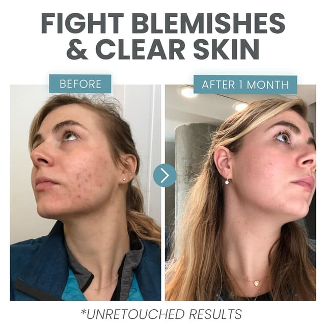 Thumbnail 3 de Vitamin C Serum for Face with Retinol 30 ml