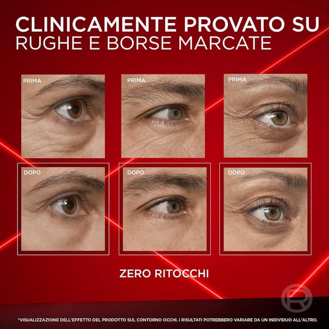 Thumbnail 6 de L'Oréal Paris Contorno Occhi 15 ml 💄