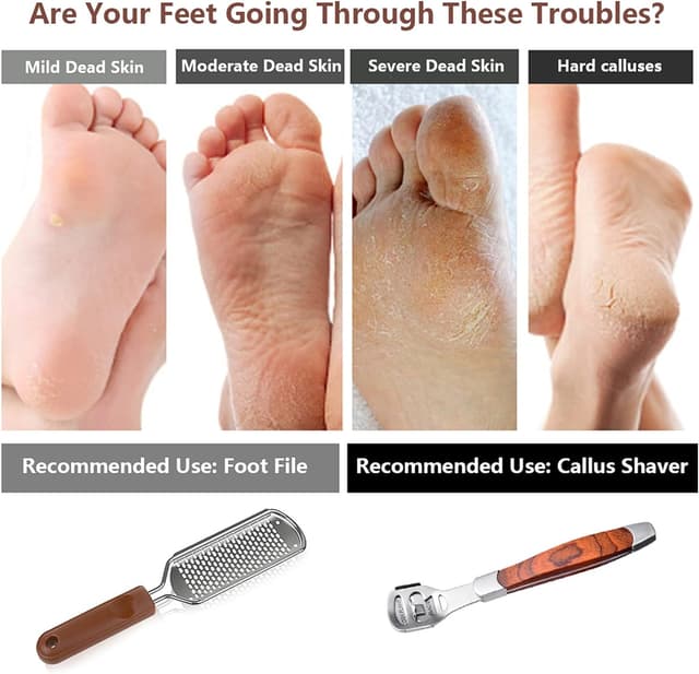 Thumbnail 4 de Colossal Foot Rasp & Wood Handle Callus Shaver 10 pack 🪮